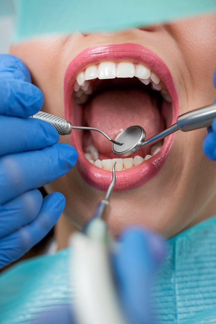 Dental Examinations